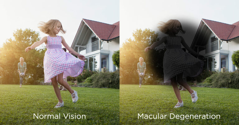 Macular Month in May Macular Month in May